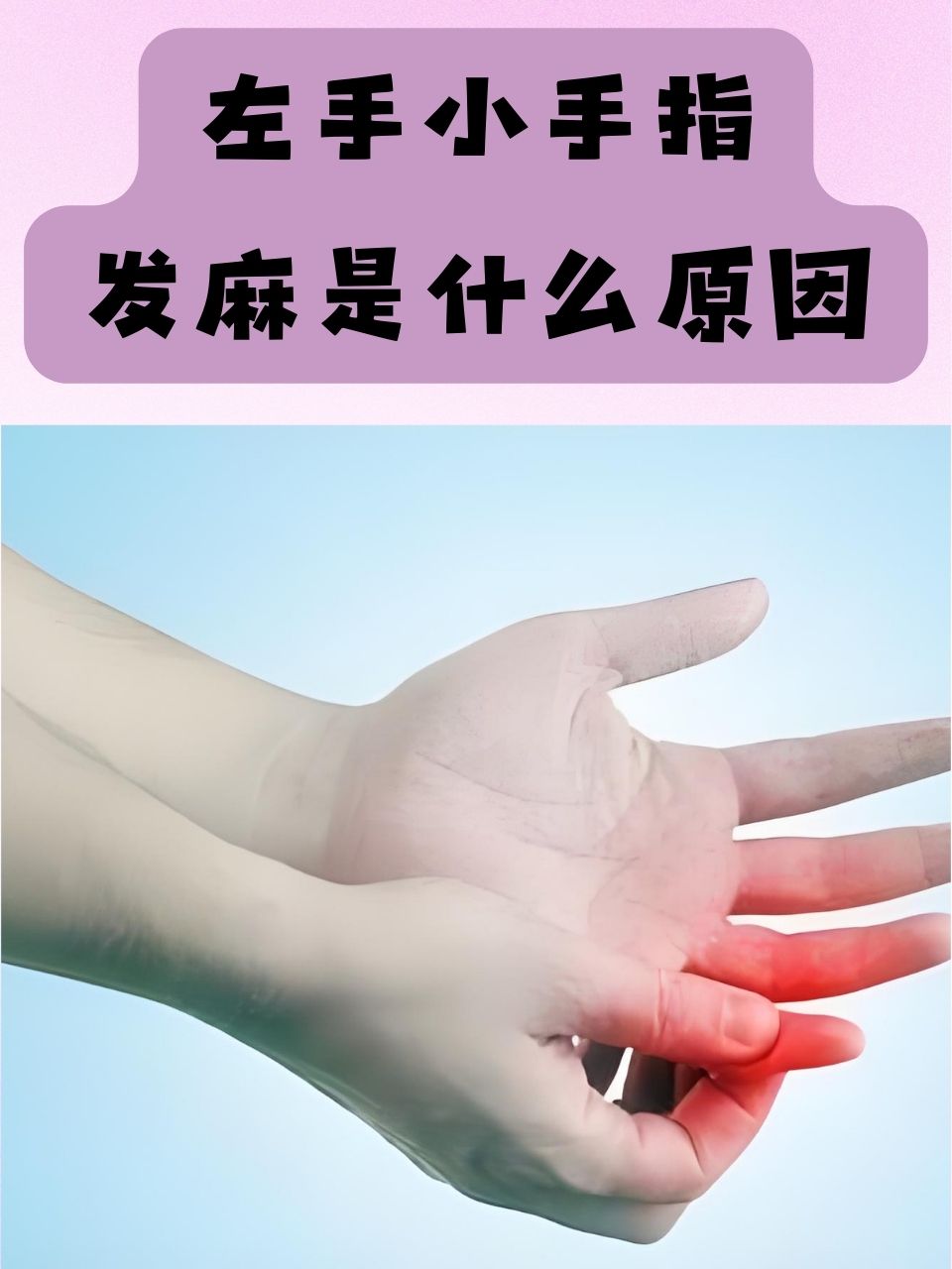 左手经常发麻是什么原因