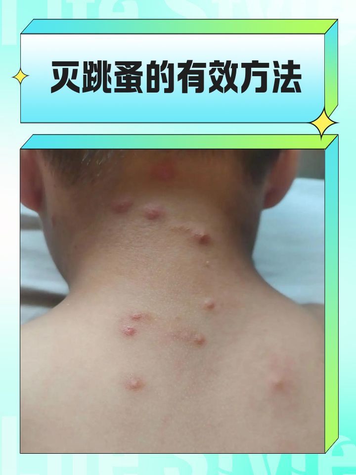 去跳蚤最简单的方法介绍
