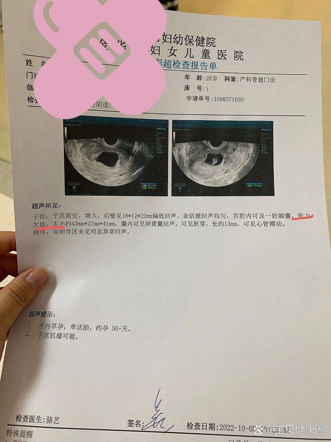 怀孕8周孕囊胎芽大小是多少