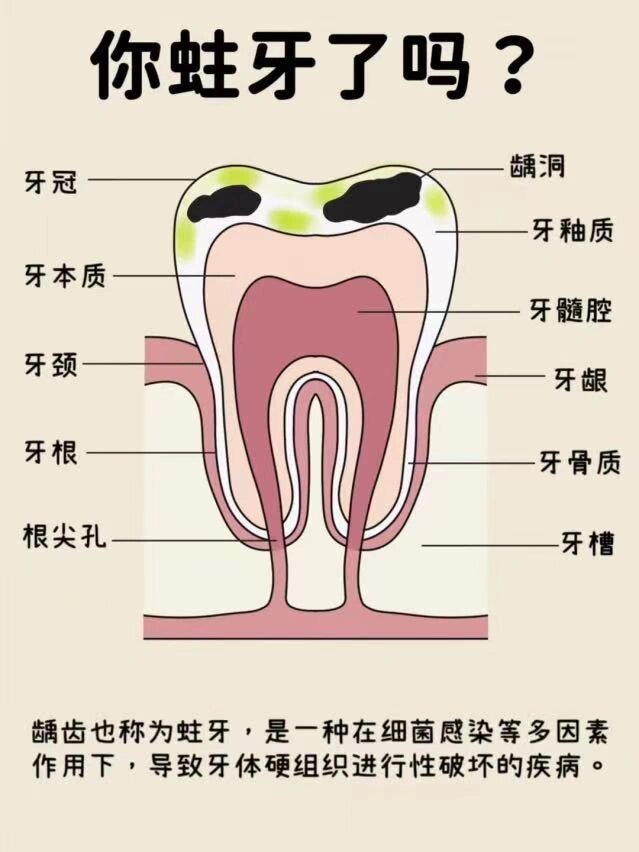 怎么才能把虫牙里的虫弄出来