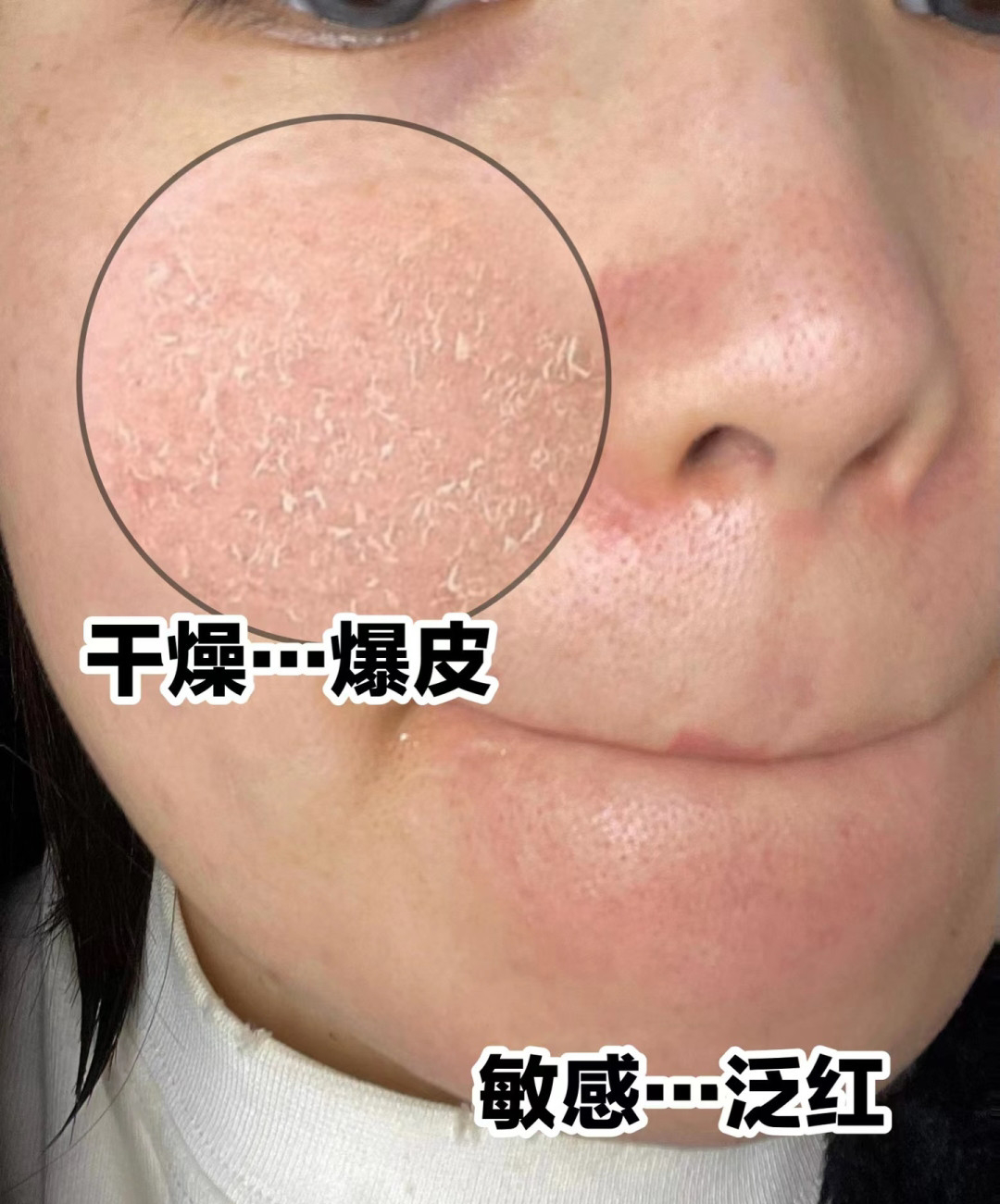 冬天怎样让皮肤不干,怎么补水保湿谢谢？