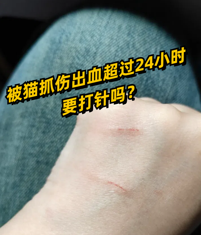 被猫挠了出血了怎么处理