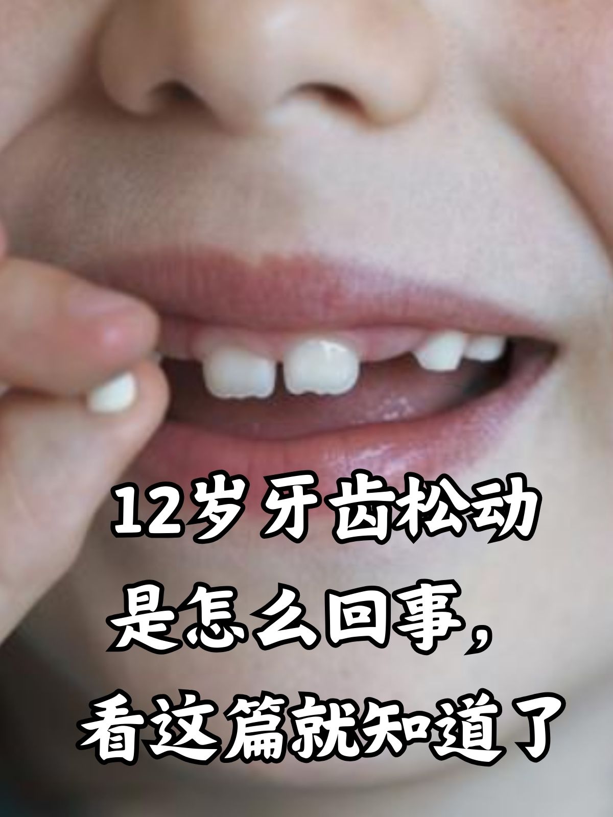 梦到牙齿松动是什么预兆