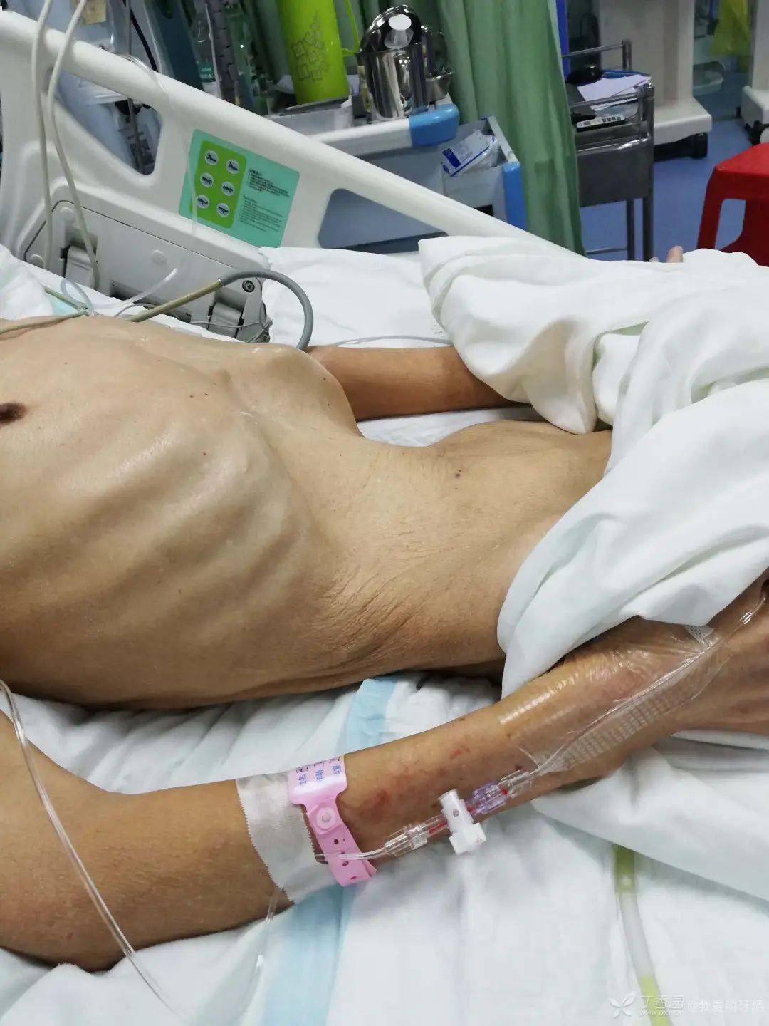 梦见车祸现场有血是什么意思