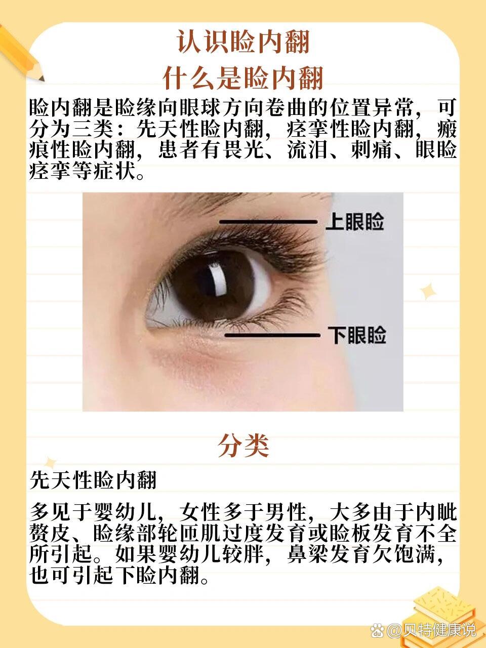 眼睑在哪里是上下眼皮里面还是眼角部位