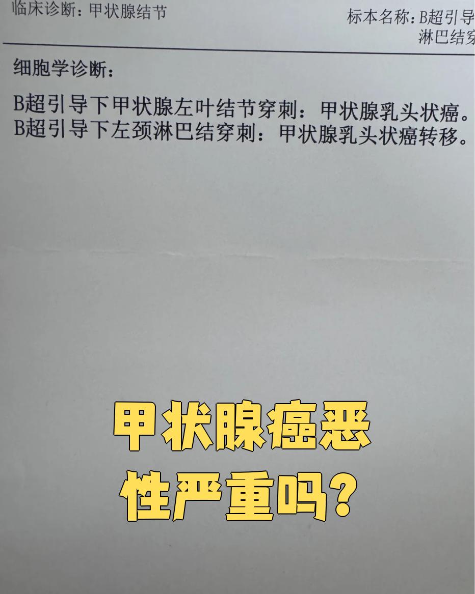 甲状腺癌算不算癌症了?