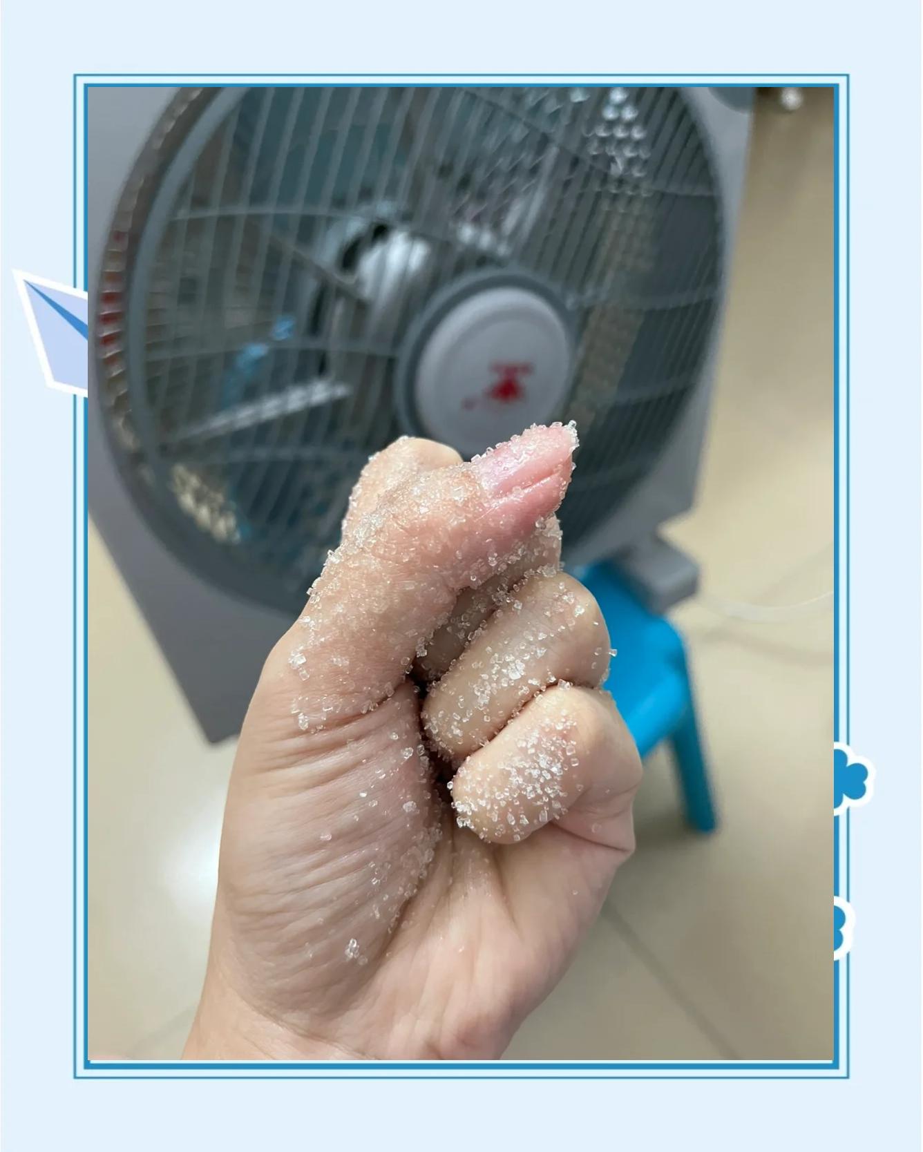 手切辣椒后5小时手还辣