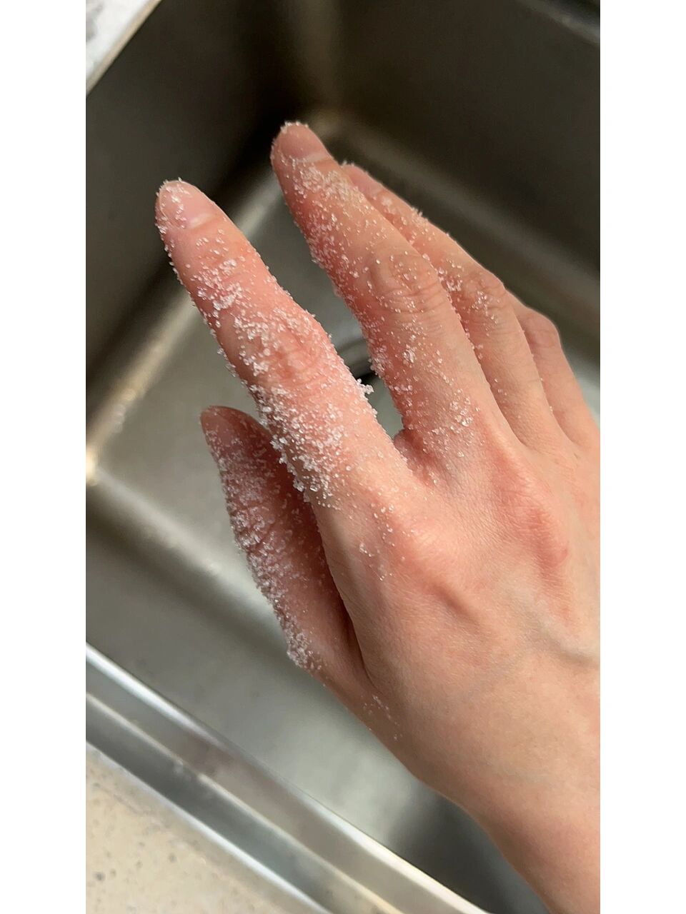 手切辣椒后5小时手还辣