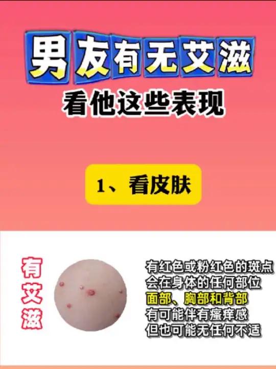 什么身体条件的人容易被检测为艾滋假阳性