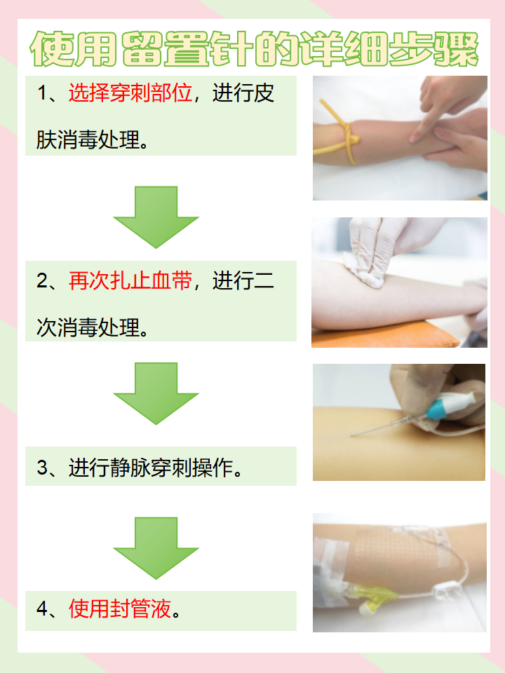 静脉留置针组成部分包括