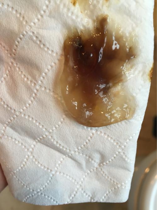 孕妇梦见自己见红了是什么征兆