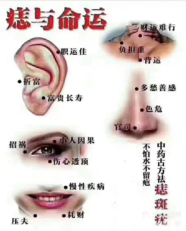 鼻子上有痣代表什么意思