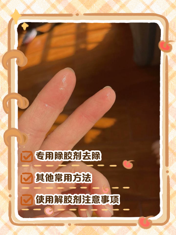 怎么洗掉手上的502胶水