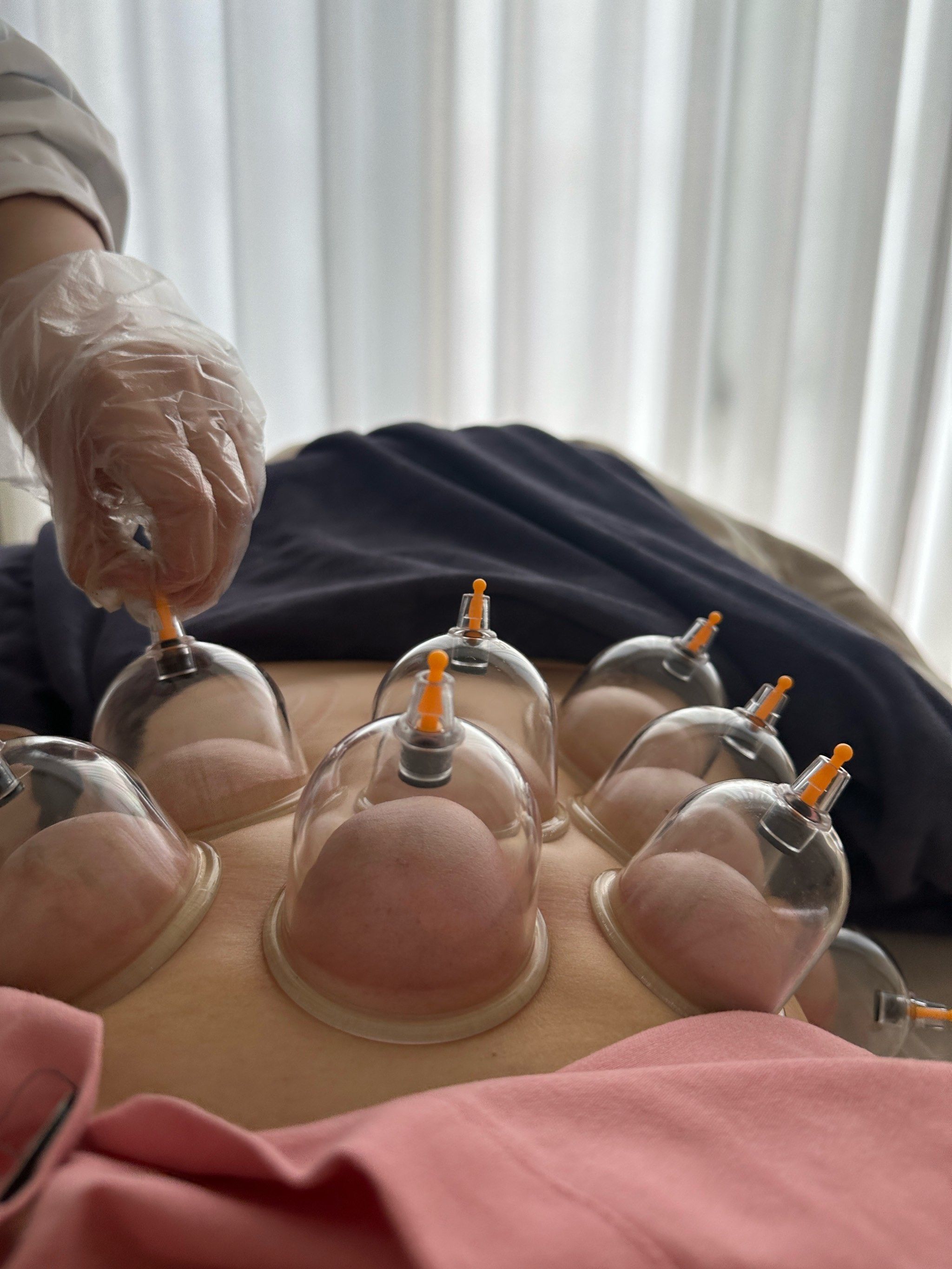 用红外线灯照肚子是否能达到消炎效果