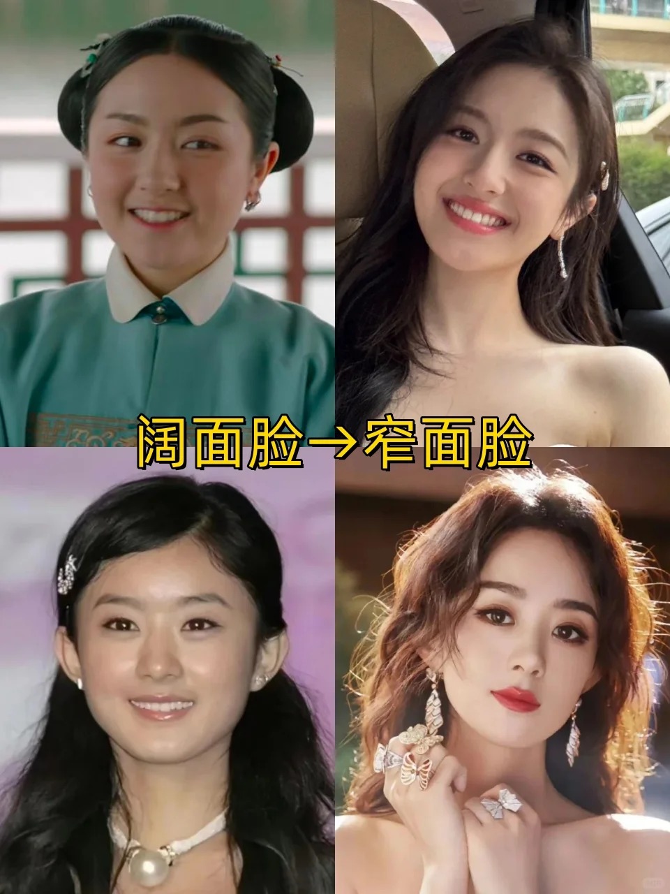 颧骨高适合有刘海还是无刘海