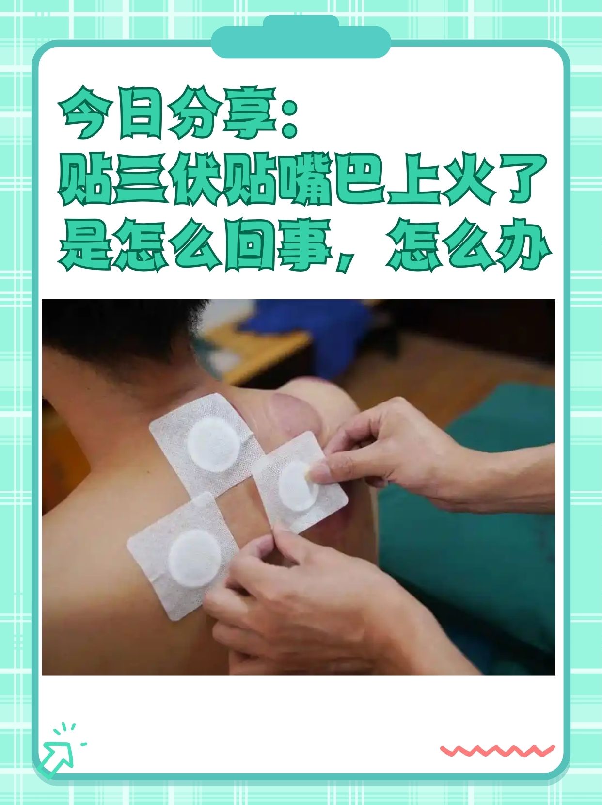 哪些人群不适宜贴三伏贴