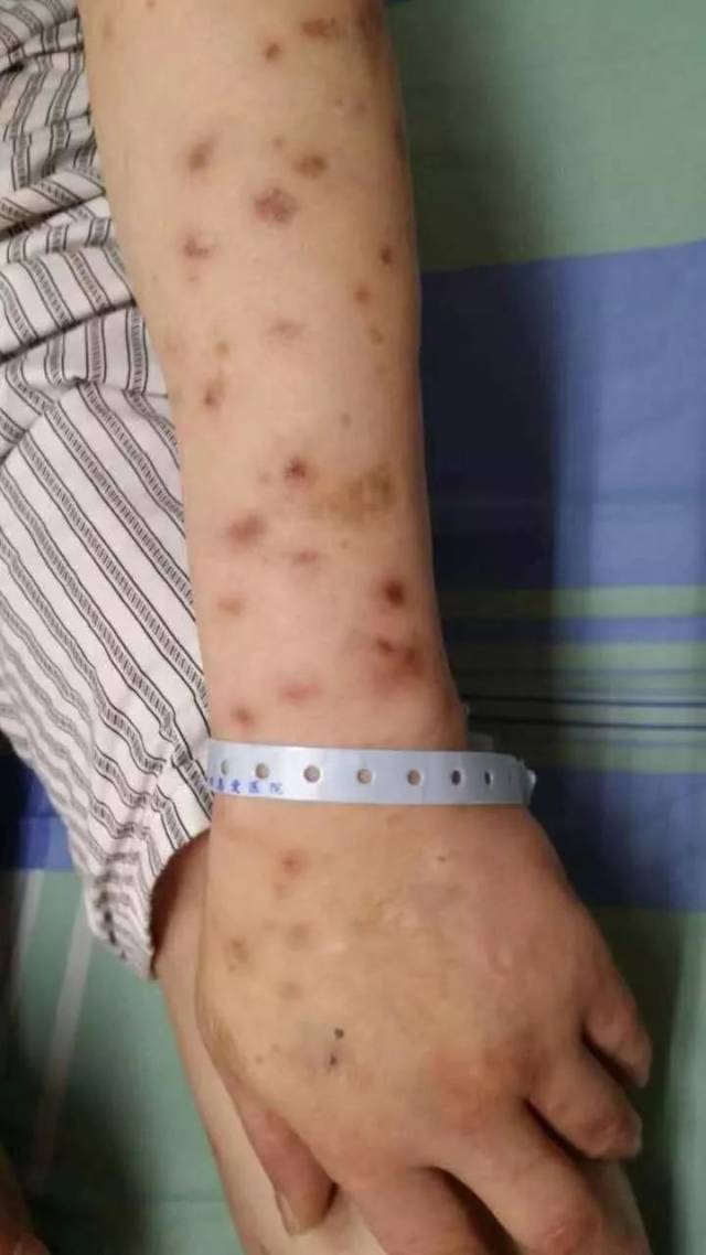 吸毒人身体散发什么味道