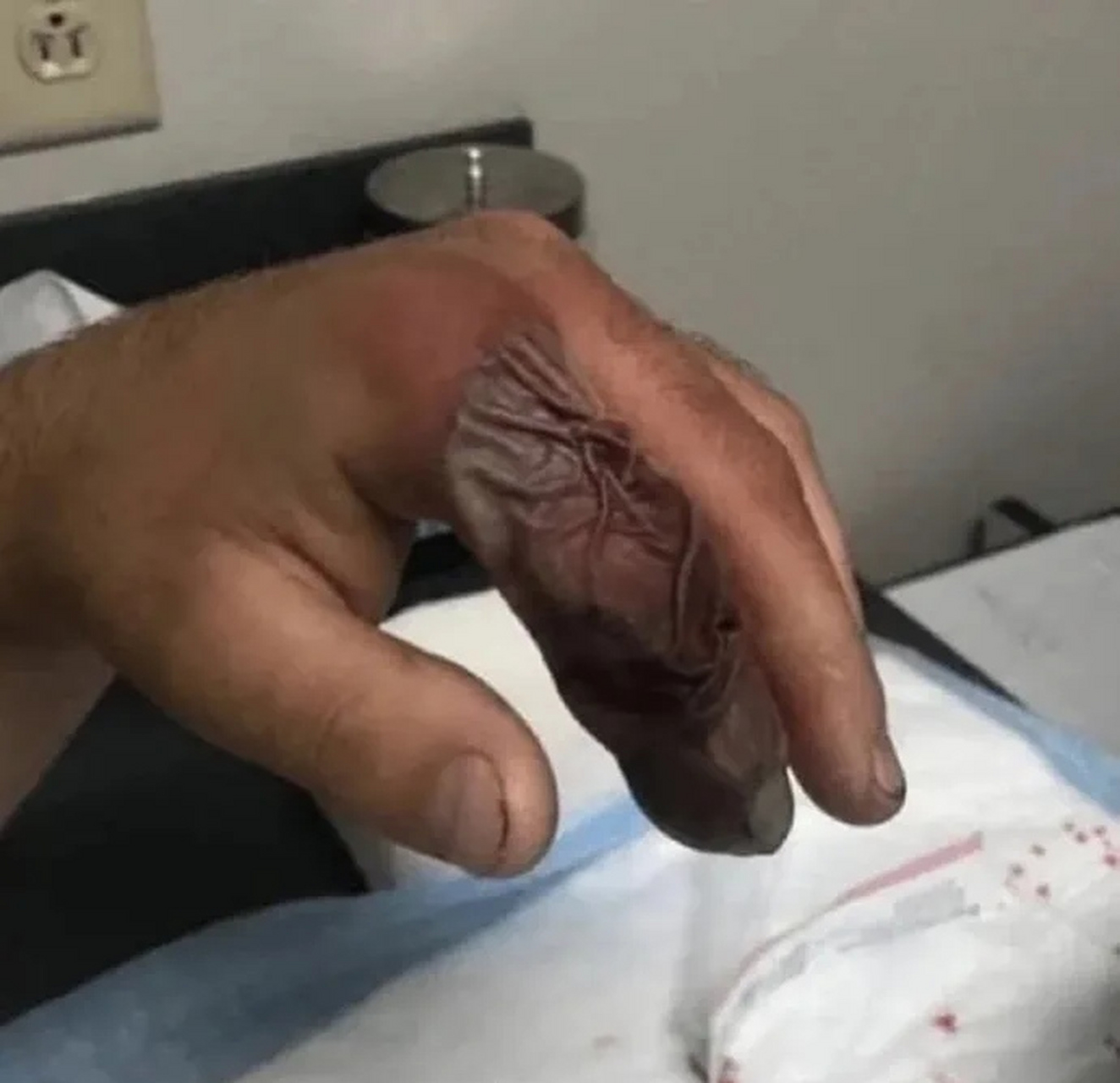 梦见被蛇咬了手是什么征兆