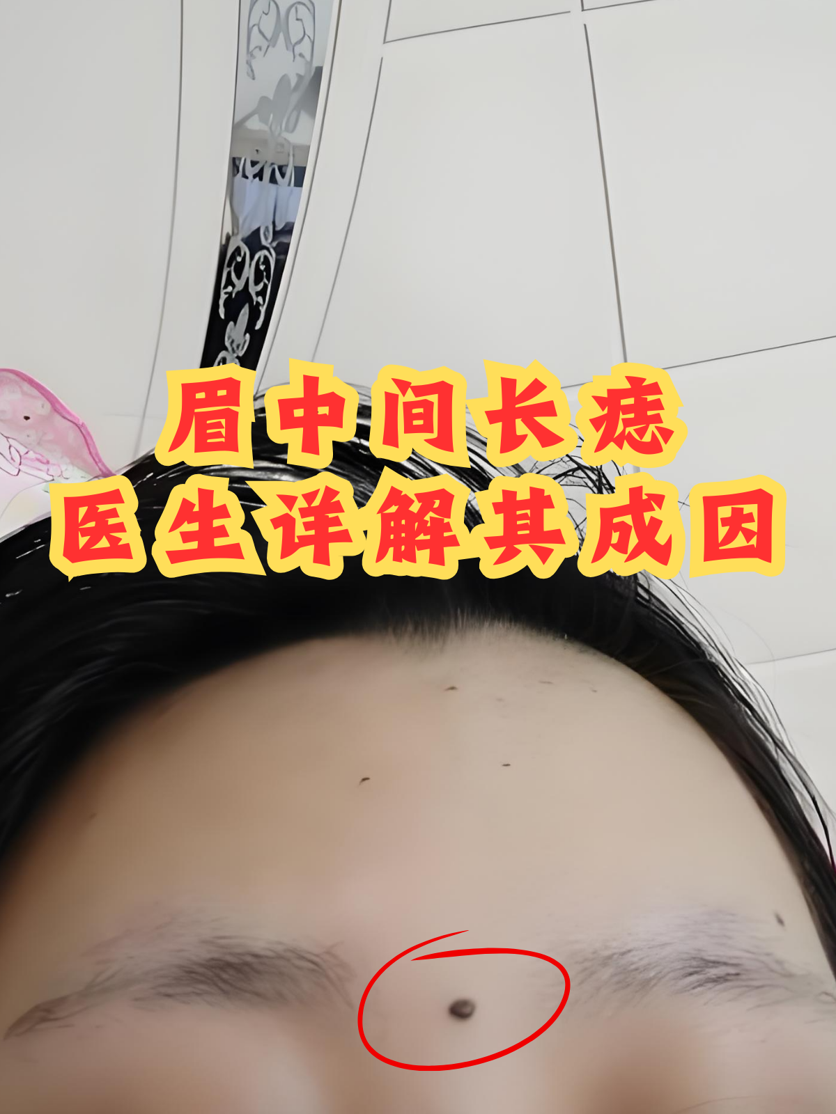 眉毛前面有痣代表什么