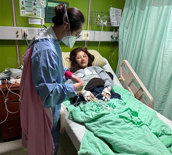 车祸后面部轻微毁容应该怎么赔偿