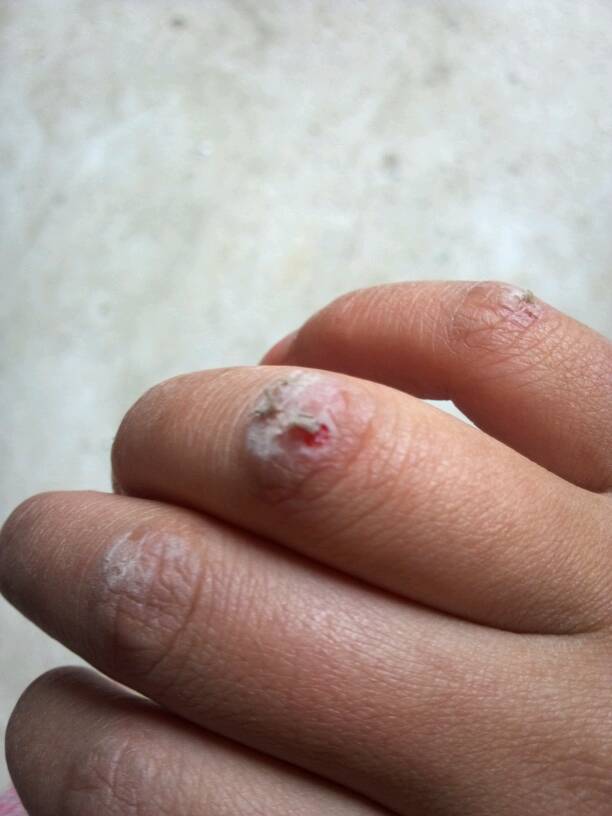 手机屏幕划着有时候粘手怎么回事呢?