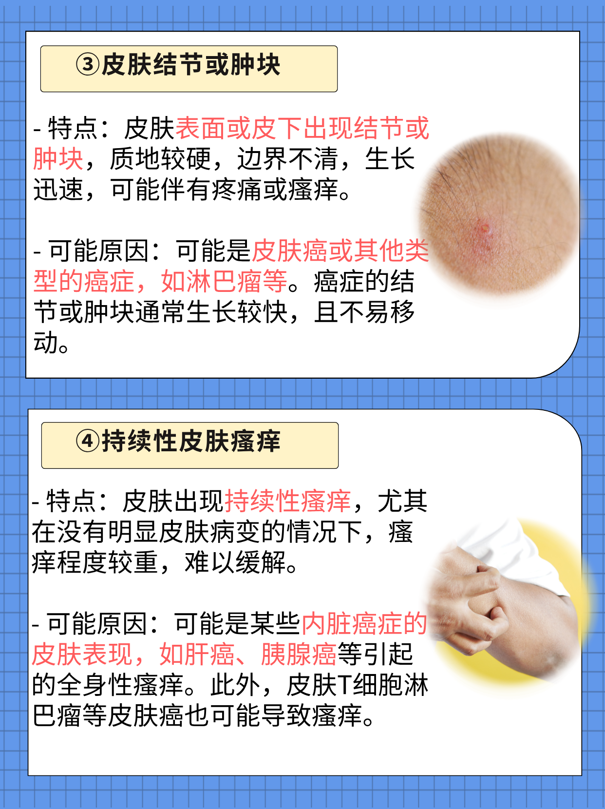 后背痒是癌症的前兆吗