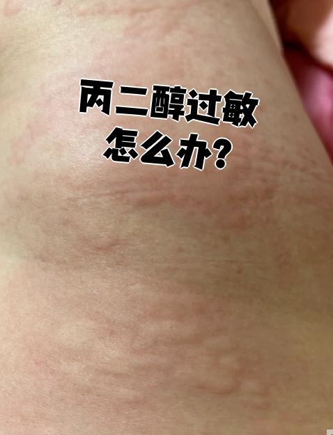 丙二醇的功效与作用是什么