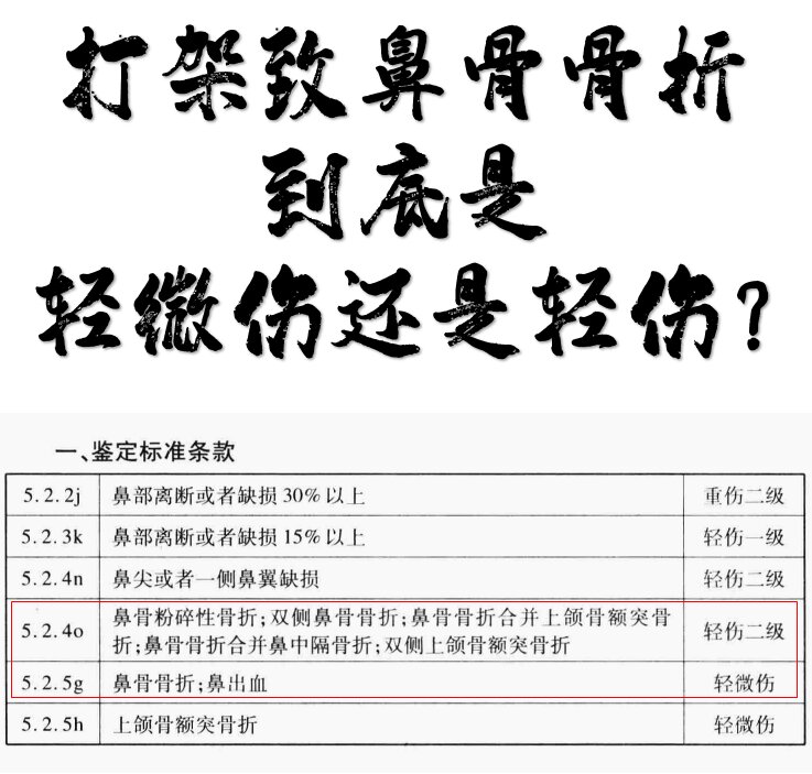 鼻子骨折赔偿标准5万?