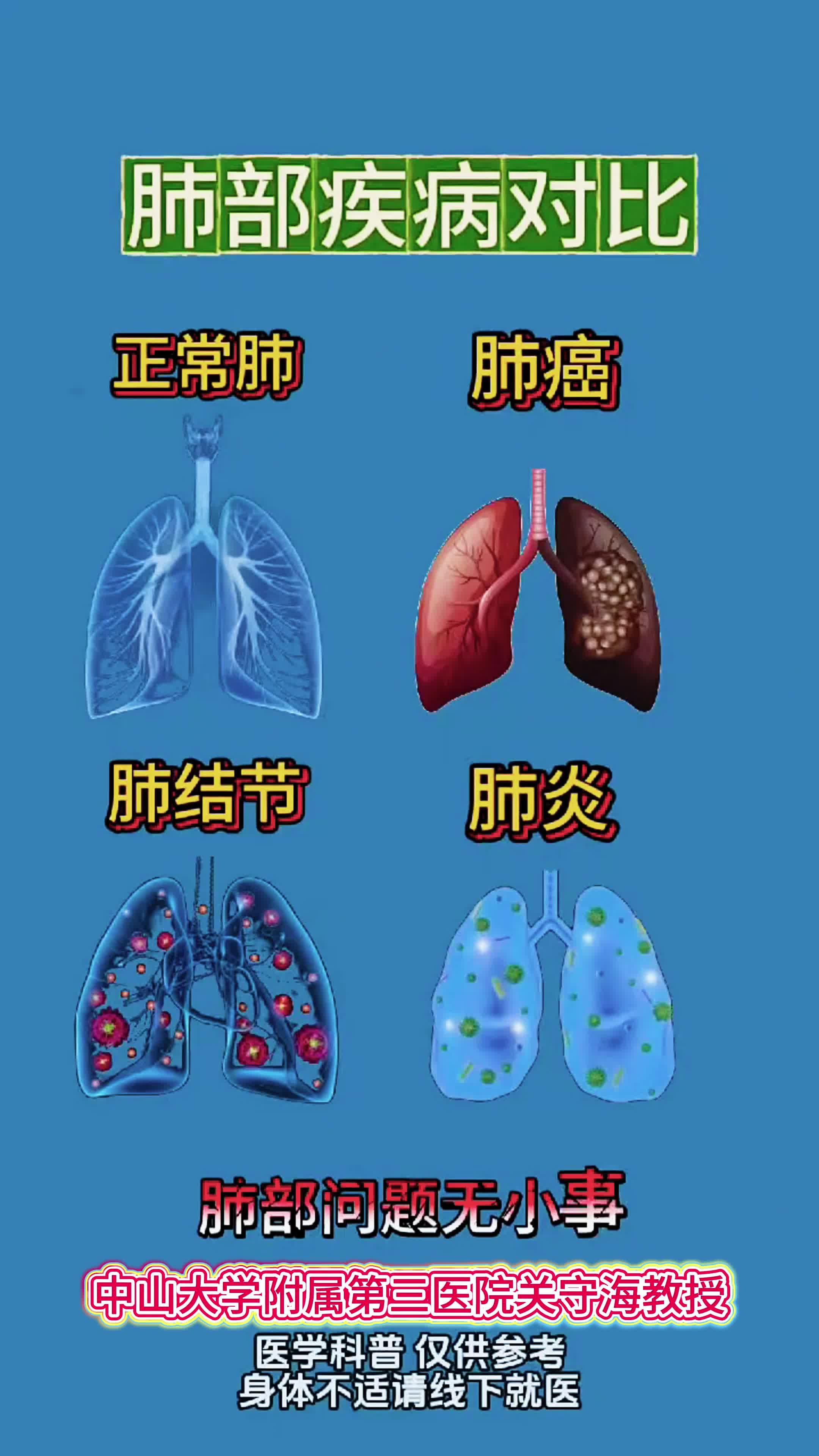 肺癌的早期症状和前兆?