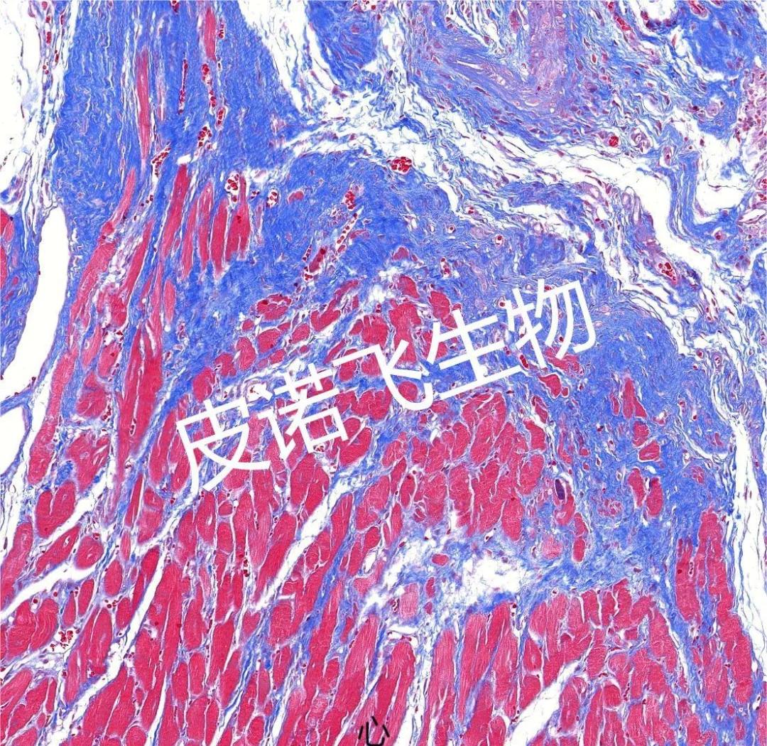 苏丹染色可将细胞内的脂滴染成什么颜色