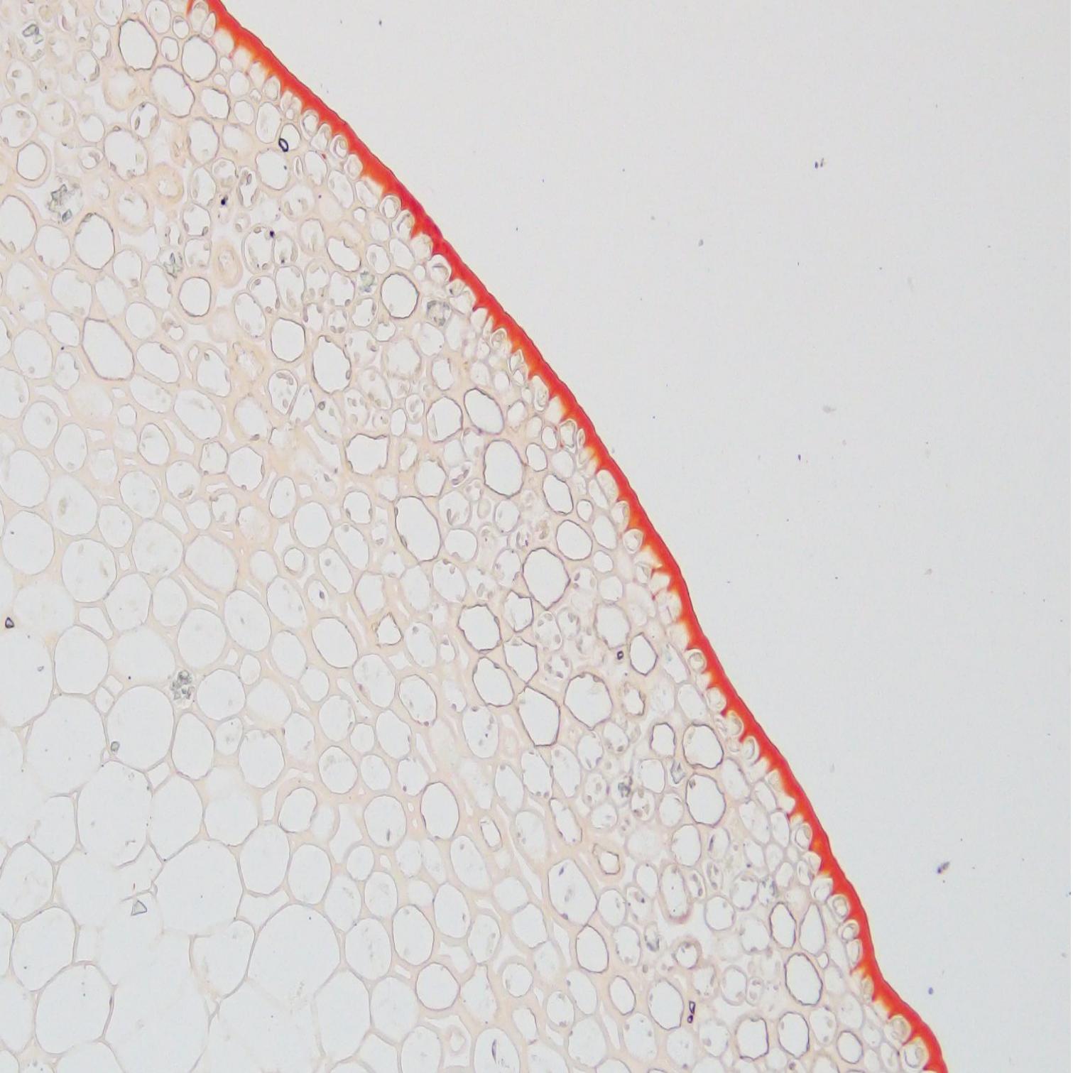 苏丹染色可将细胞内的脂滴染成什么颜色