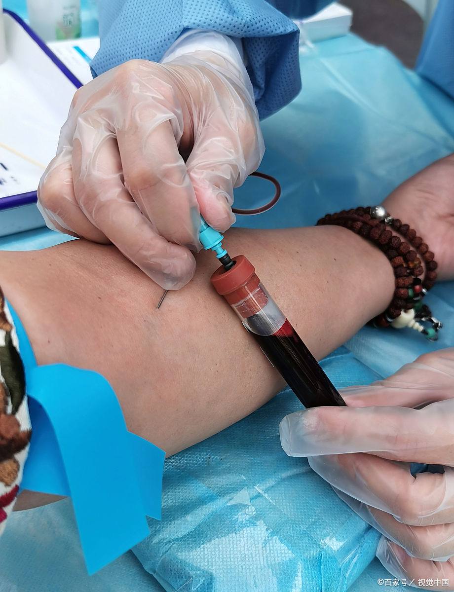 捐骨髓对身体有什么伤害