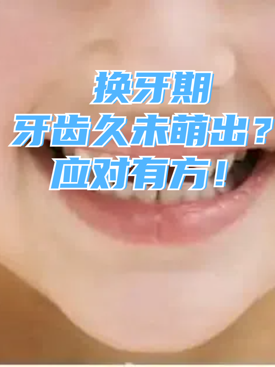 梦到自己牙齿掉了是什么意思