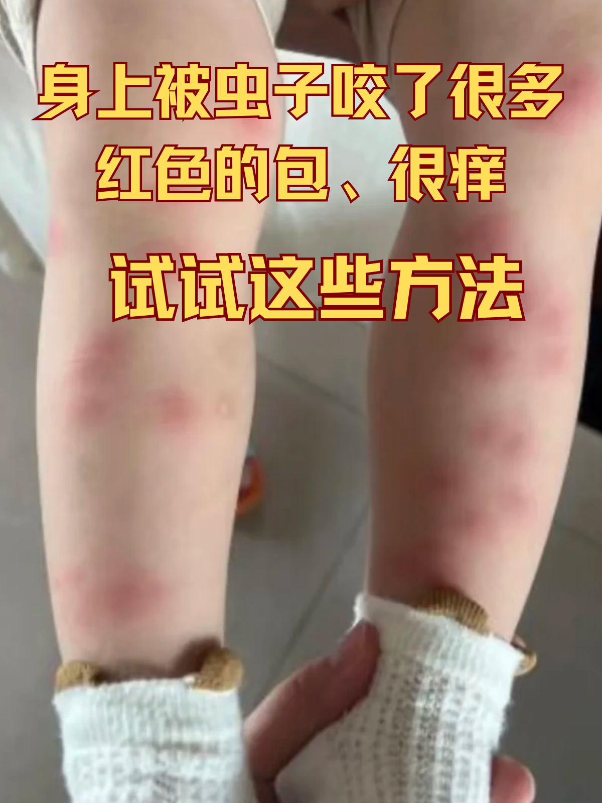 有一种很小的虫子咬人特别痒