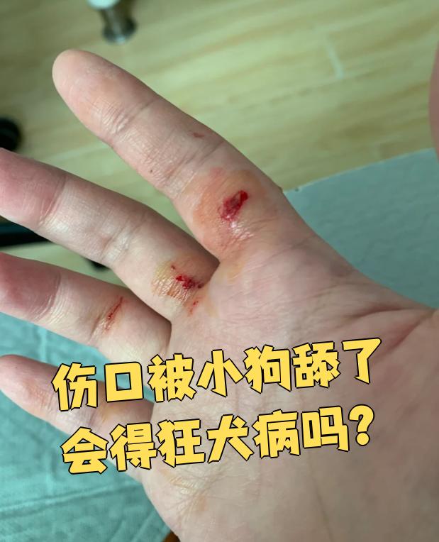 狗咬的伤口图片是什么样的