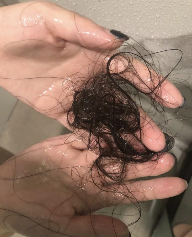 周公解梦梦见自己掉头发