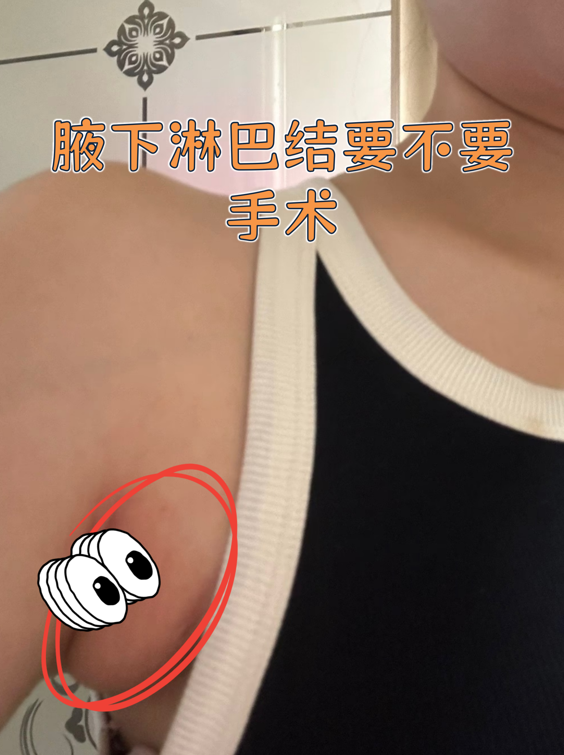 腋窝淋巴结检查顺序是什么