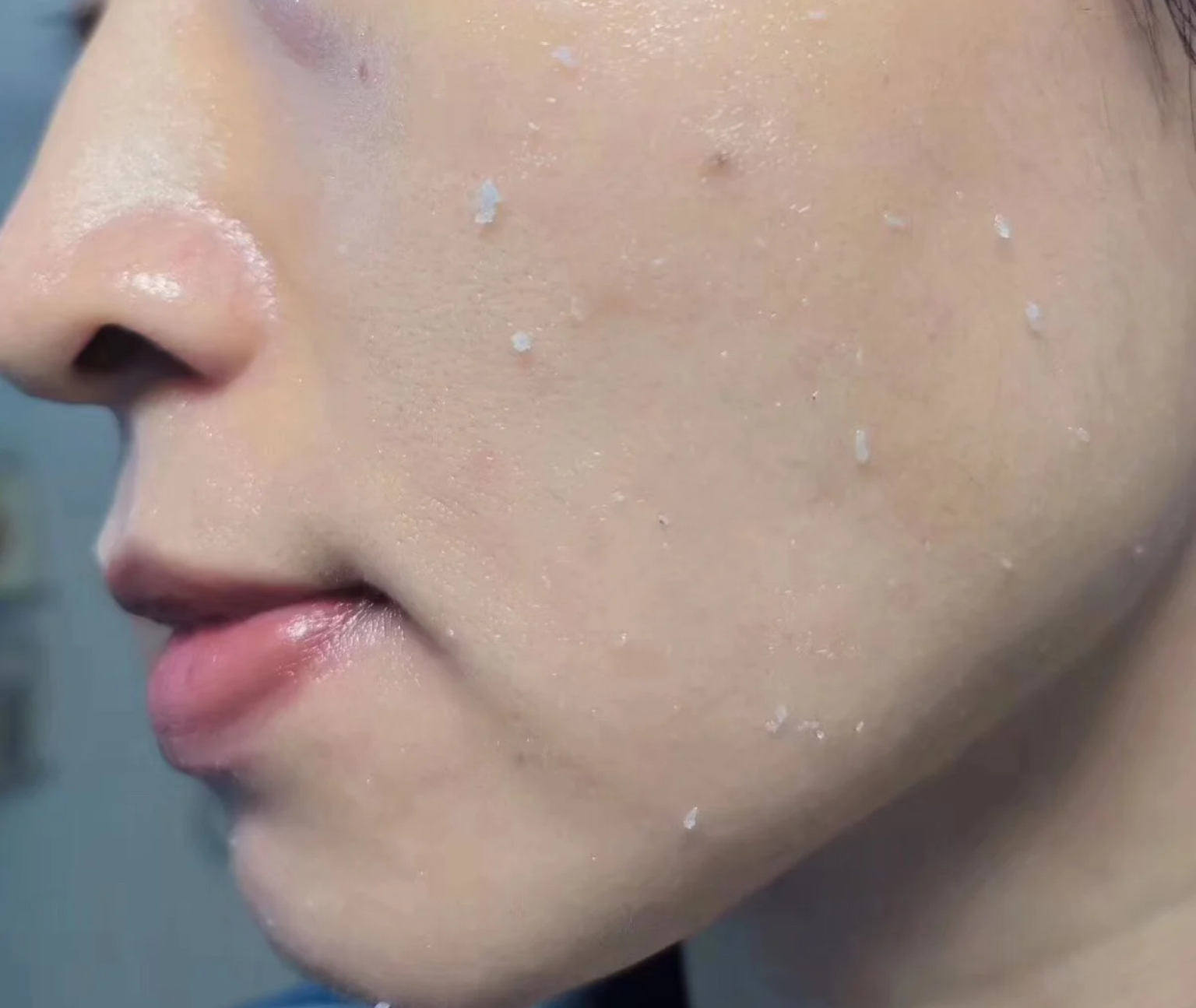 护肤品搓泥是什么原因